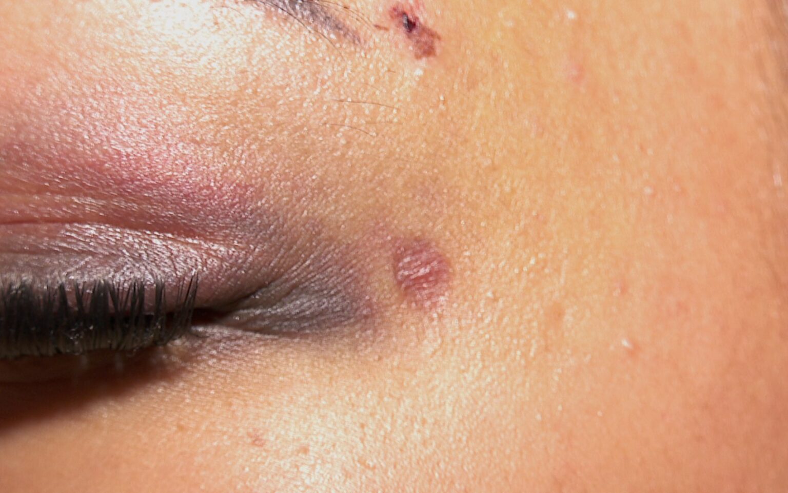 Jovem Agredida por Ex-Namorado Denuncia Omissão em Condomínio: ‘Funcionária Perguntou se Devia Chamar a Polícia?’ Jovem Agredida por Ex-Namorado Denuncia Omissão em Condomínio: 'Funcionária Perguntou se Devia Chama