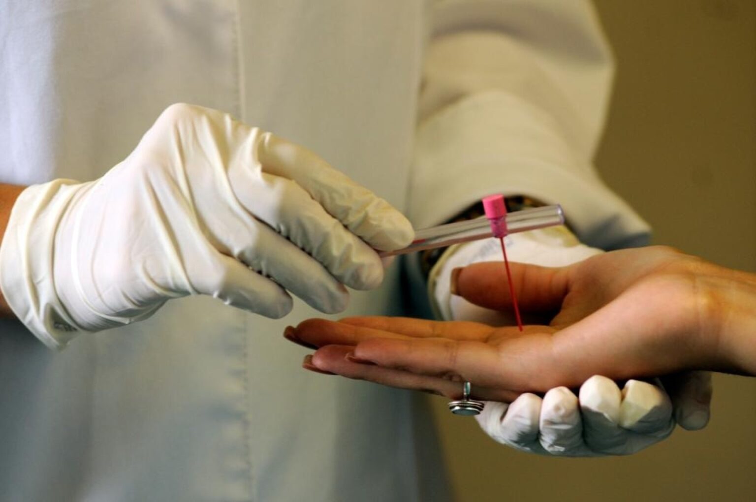 Mato Grosso Intensifica Ações Contra a Hanseníase Durante o Janeiro Roxo