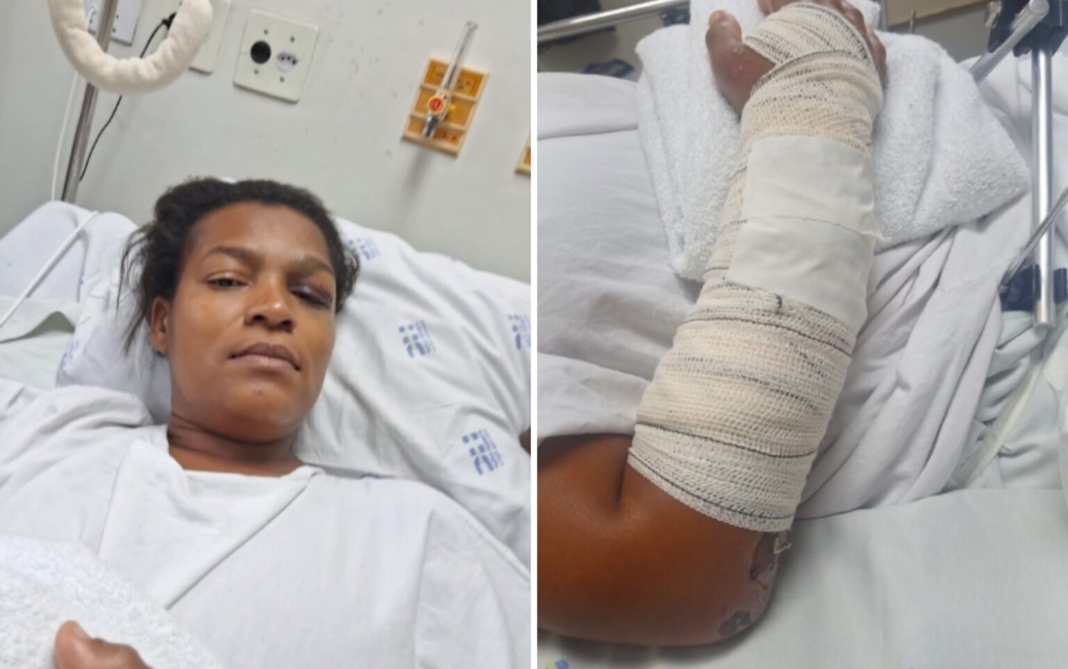Mulher atropelada com filho em Ribeirão Preto fala sobre recuperação e pede justiça