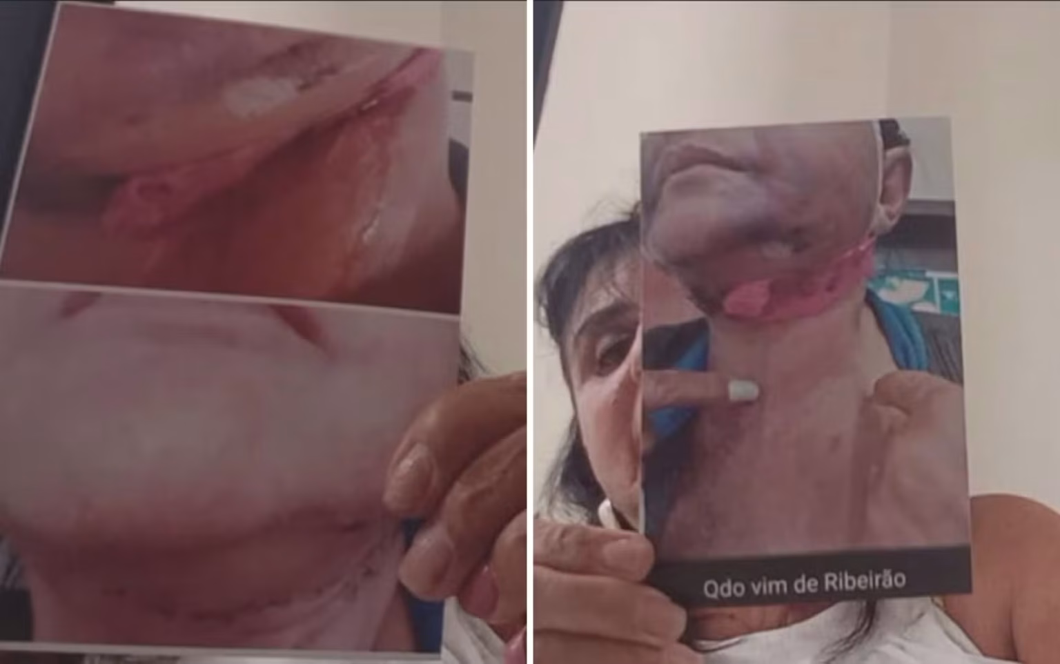 IML Confirma Lesões Graves em Paciente de Dentista Denunciada por Complicações Estéticas