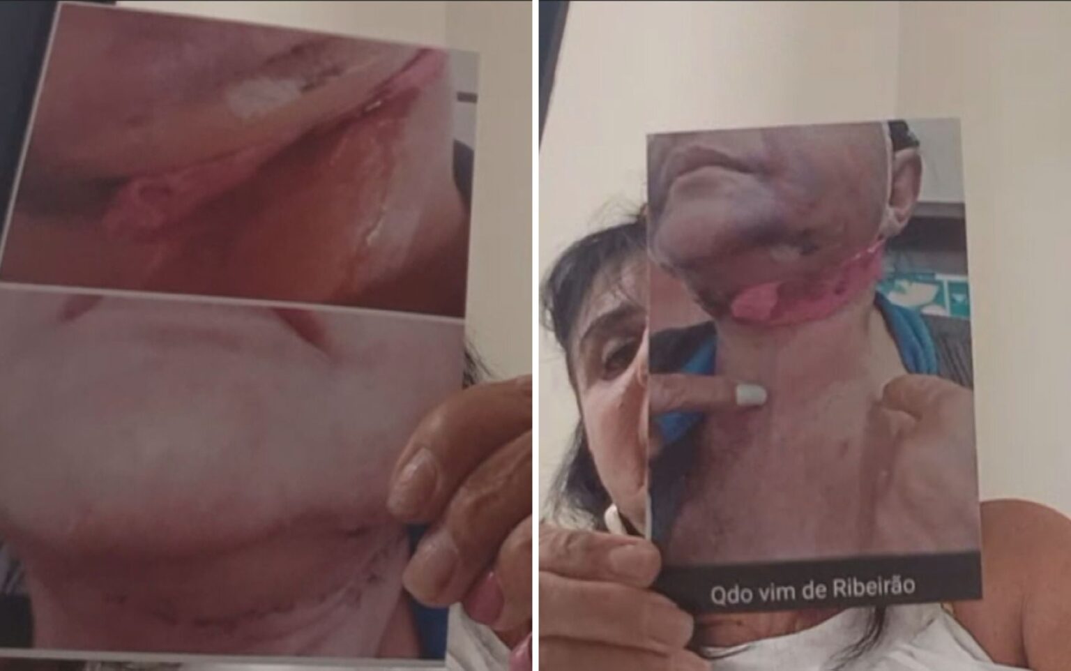 IML confirma lesões graves em paciente de dentista denunciada por falhas em procedimentos estéticos