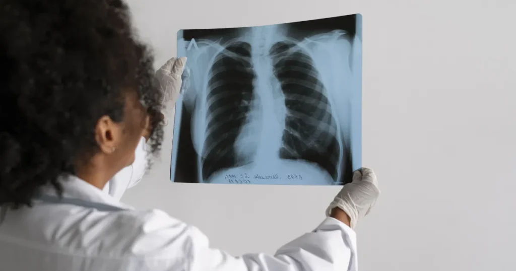 Obesidade e Inflamação: Perigos Ocultos para a Saúde Pulmonar Obesidade e Inflamação: Perigos Ocultos para a Saúde Pulmonar