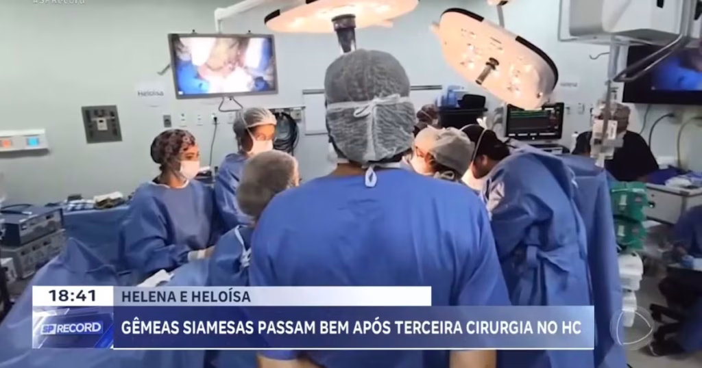 Gêmeas Siamesas Passam por Terceira Cirurgia de Separação em Ribeirão Preto: Um Passo Importante na Recuperação Gêmeas Siamesas Passam por Terceira Cirurgia de Separação em Ribeirão Preto: Um Passo Importante na