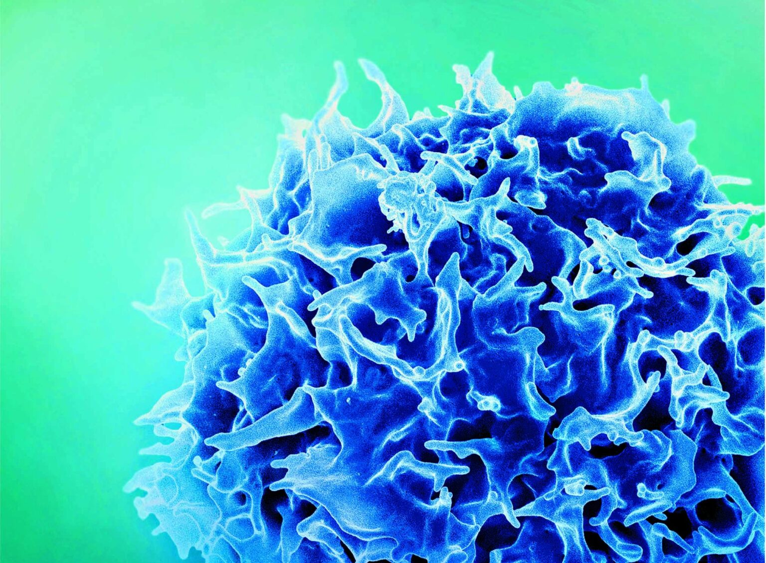 Instituto Butantan e IASO Bio: Parceria para Terapia CAR-T Revoluciona Tratamento do Câncer no Brasi